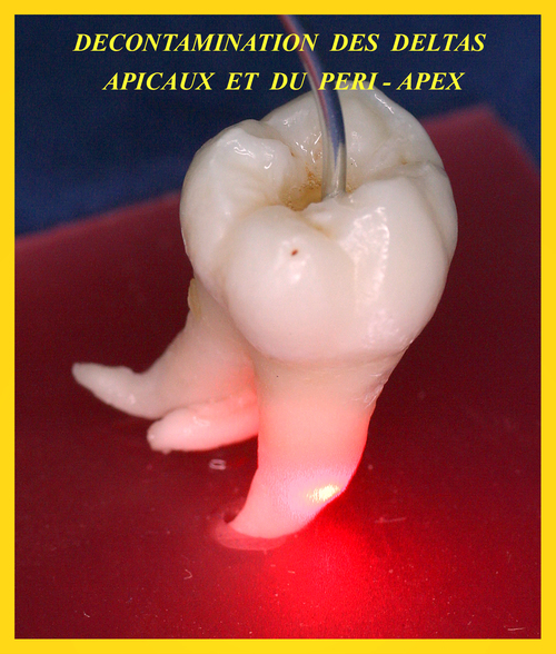 Dentiste laser Strasbourg Tivoli 67